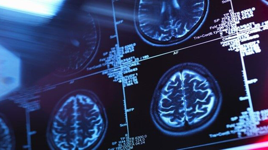 West Midlands Imaging Network